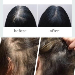 100% Organic non-Gmo hair growth serum